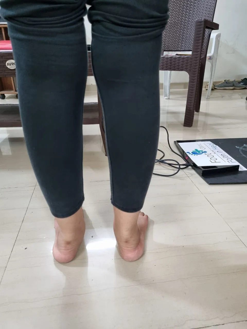 Foot Pronation