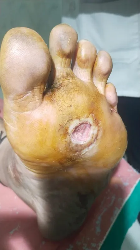 Treated Condition 11