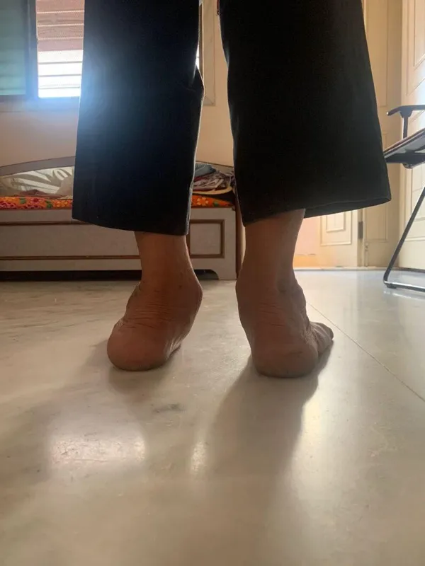 Treated Condition 16