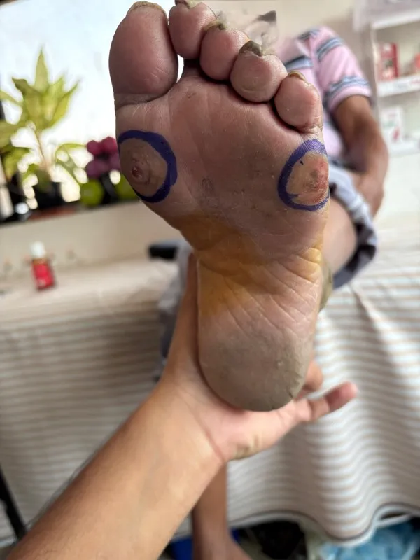 Treated Condition 2