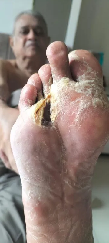 Treated Condition 23
