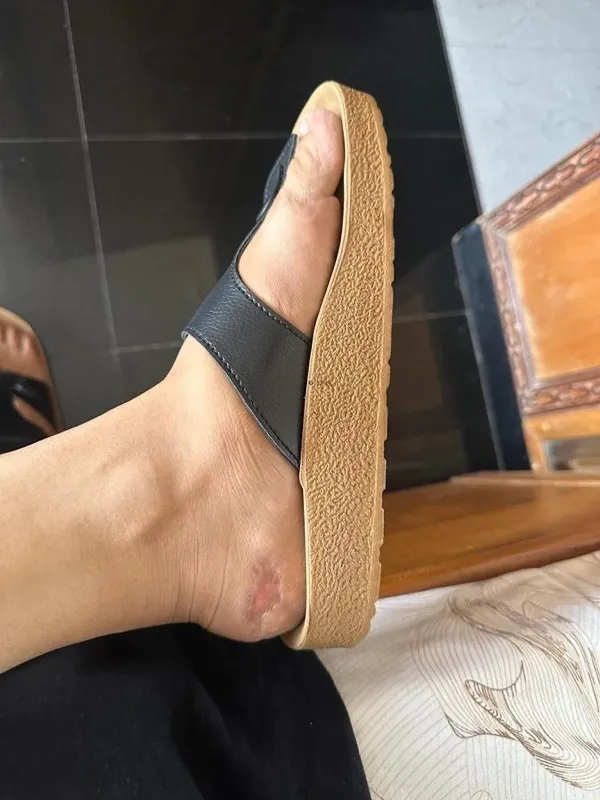 Treated Condition 26