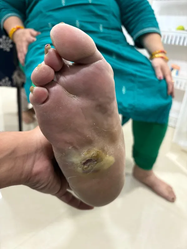 Treated Condition 3