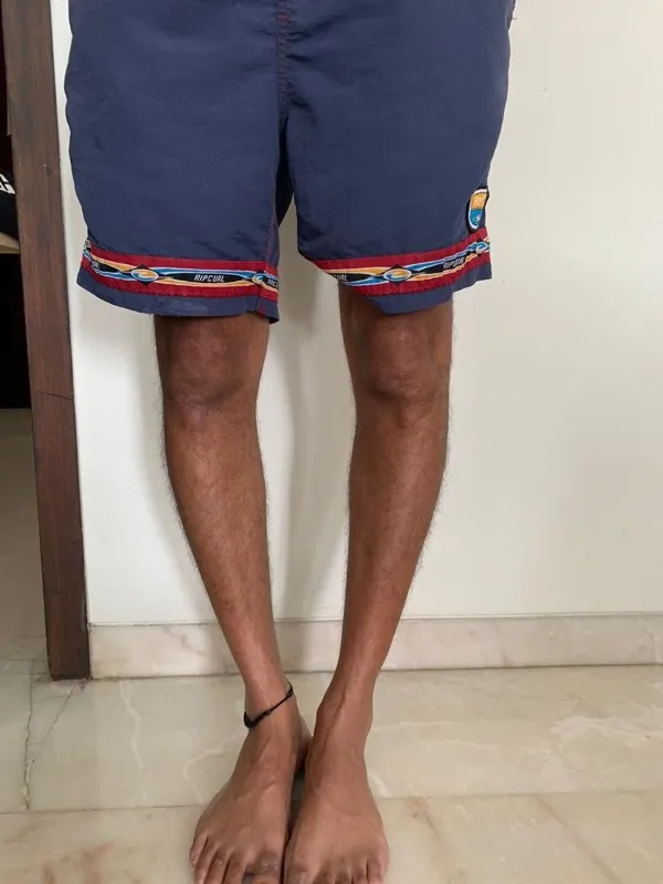 Treated Condition 30