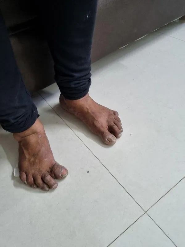 Treated Condition 36