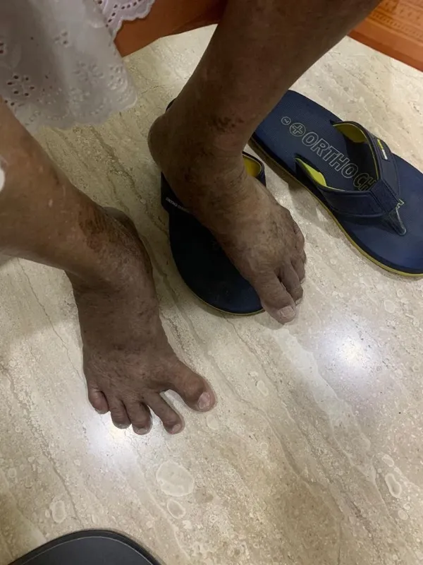 Treated Condition 37