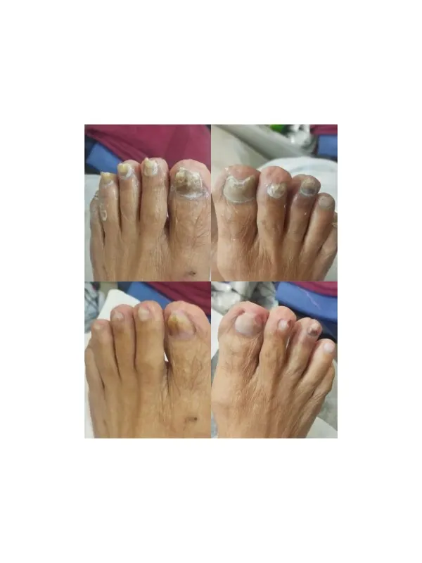Treated Condition 41