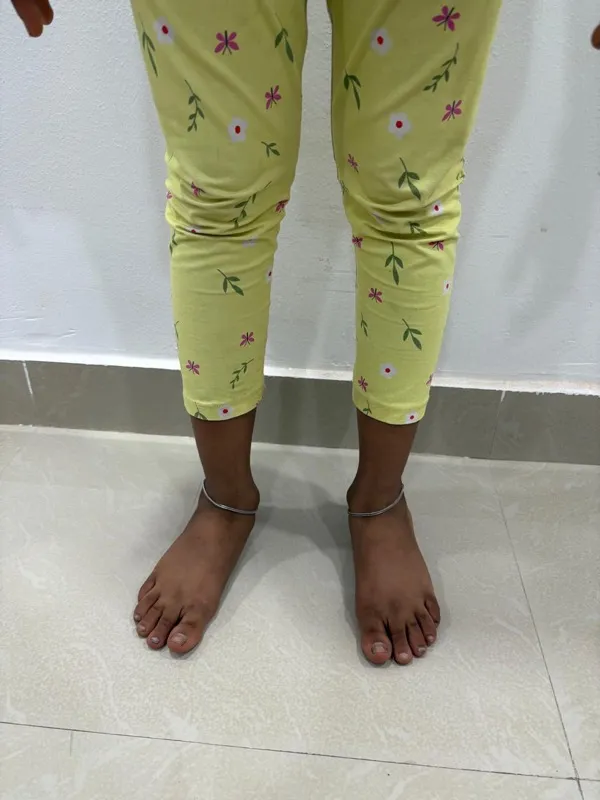 Treated Condition 46