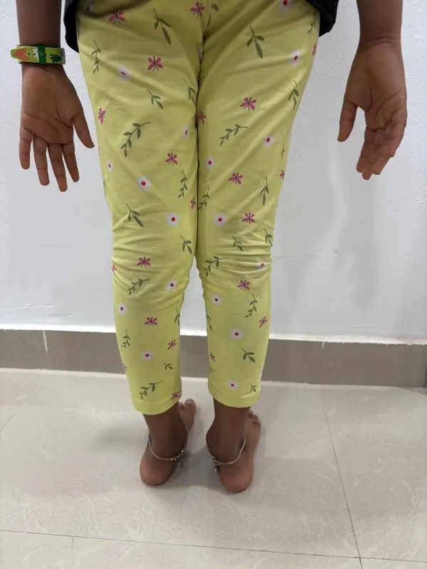 Treated Condition 48