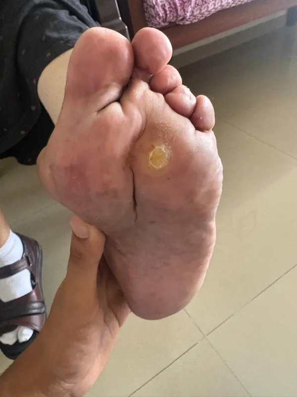 Treated Condition 61