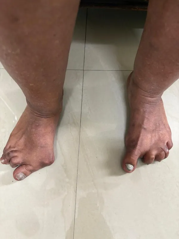 Treated Condition 64
