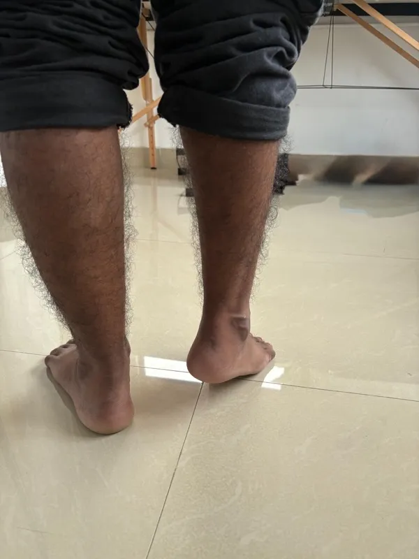 Treated Condition 7