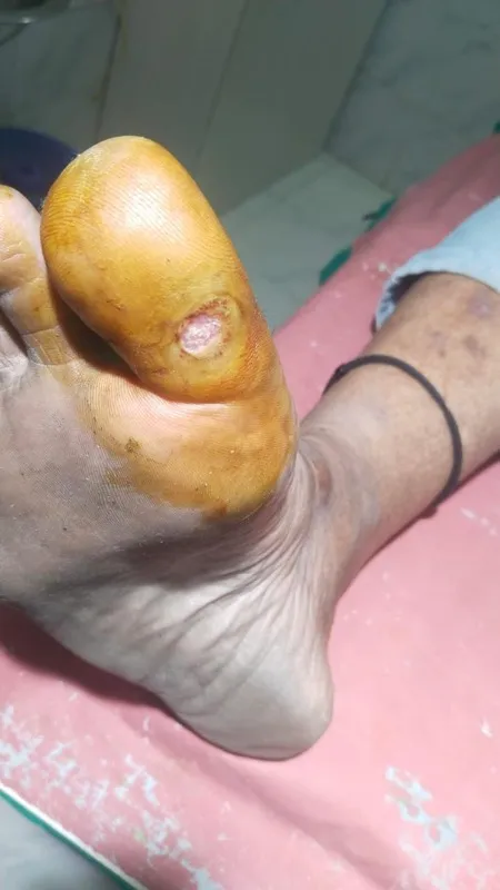 Treated Condition 9