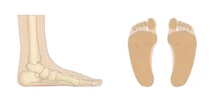 Pronated Foot Structure